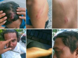 Warga Desa Wonorejo Jadi Korban Pengeroyokan di Depan Stadion Gelora Joko Samudro Gresik