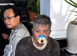 Polres Pasuruan Lamban Tangani Kasus Pengeroyokan Pengusaha Rental Mobil