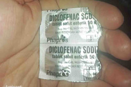 Sakit Gigi, Panduan Pilih Obat Natrium atau Kalium Diklofenak
