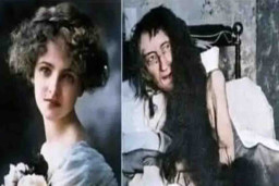 Kisah Blanche Monnier, 25 Tahun Terkurung Demi Sebuah Cinta