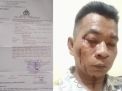 Wartawan Hampir Tewas Jadi Korban Pengeroyokan Malah Mau Jadi Tersangka
