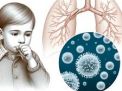 Tanggapan IDAI Mengenai Kewaspadaan Terhadap Terjadinya Pneumonia