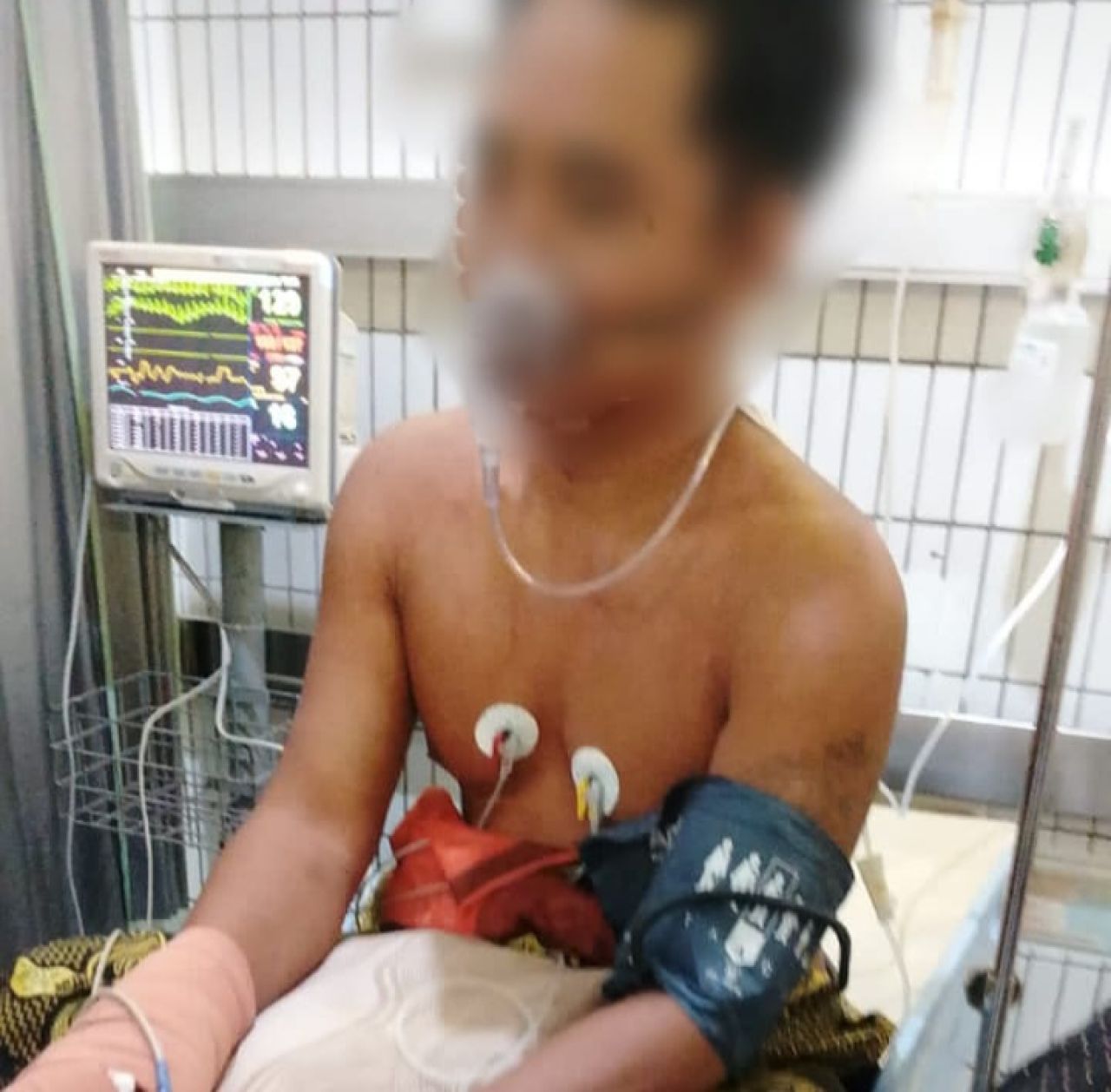 N dirawat di RSUD Dr Soetomo Surabaya