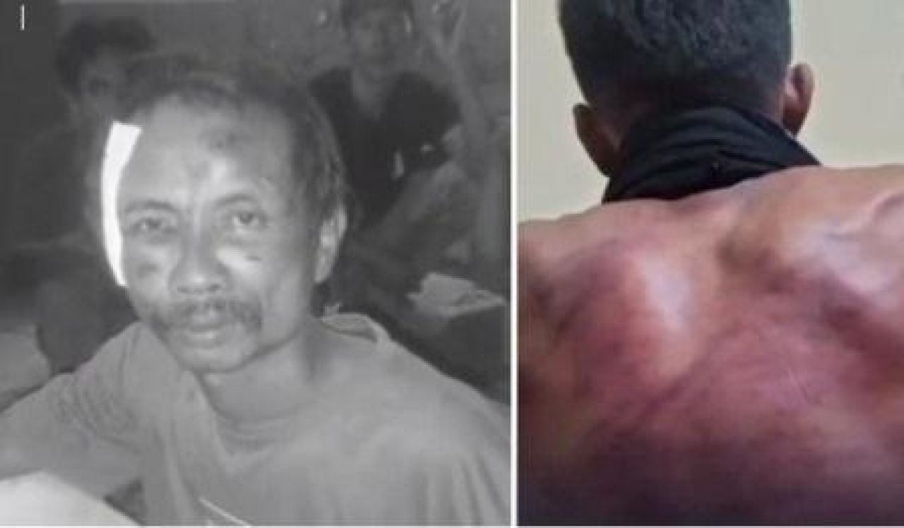 Warga yang dihajar oknum Brimob