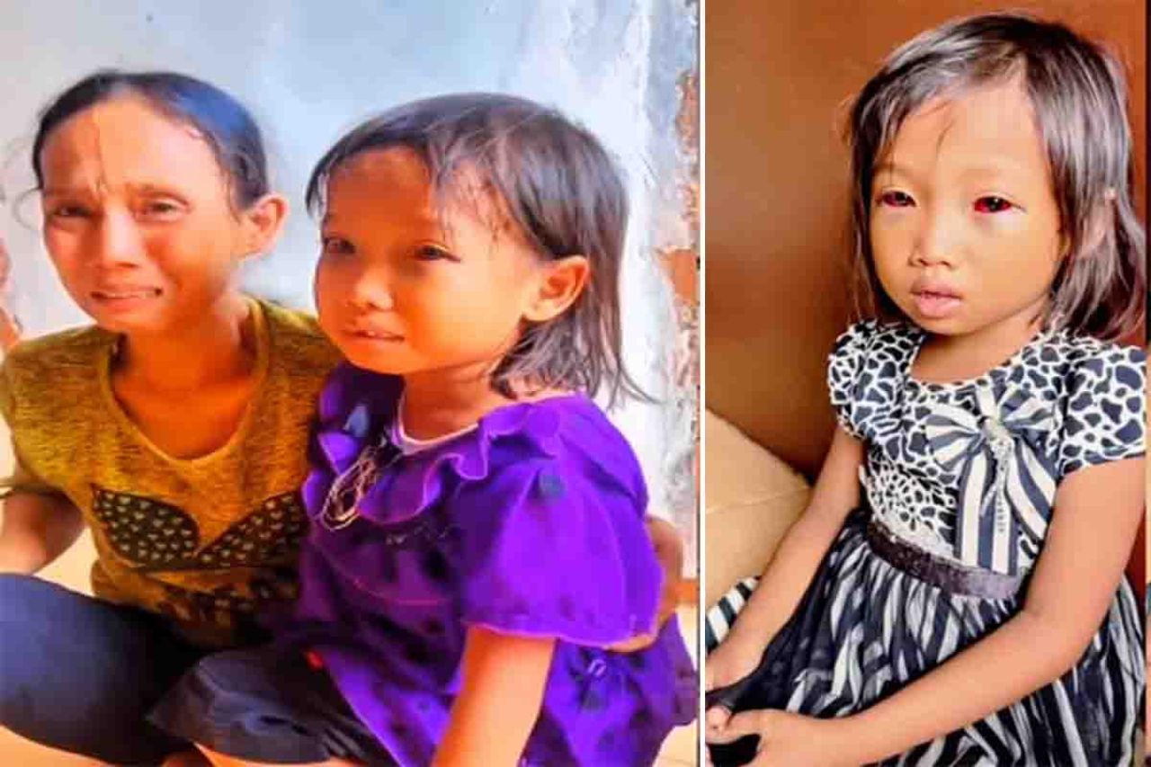 Erna dan Fatiyah sebelum dirawat di Rumah Sakit Bari