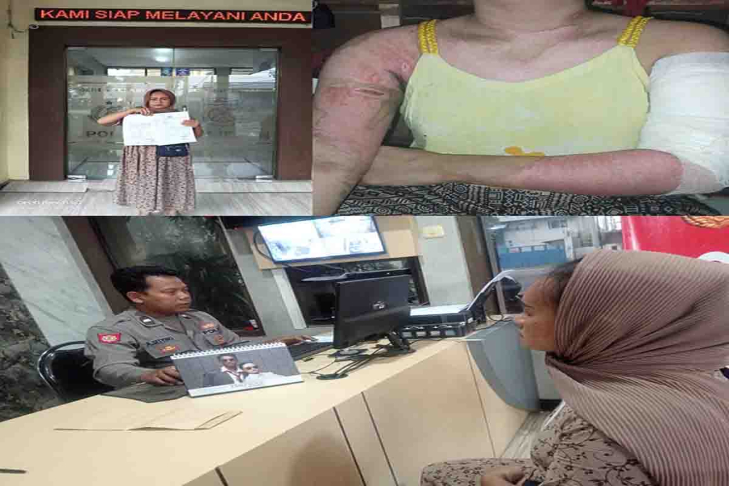 Kondisi luka dari Ana Fitria. Dan Lisyeroh saat laporan