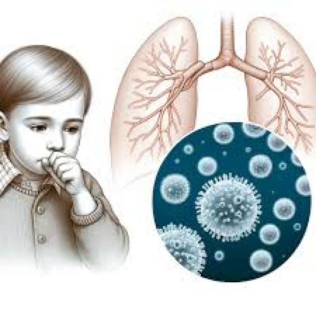 Mycoplasma pneumonia pada anak